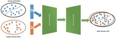 Automatic sleep staging of single-channel EEG based on domain adversarial neural networks and domain self-attention